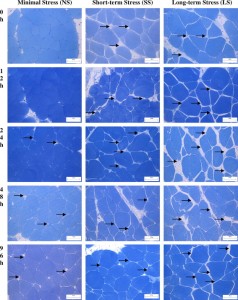 Image showing muscle damage due to stress. Stolen without permission from: dkdkdkdkdk (see references)